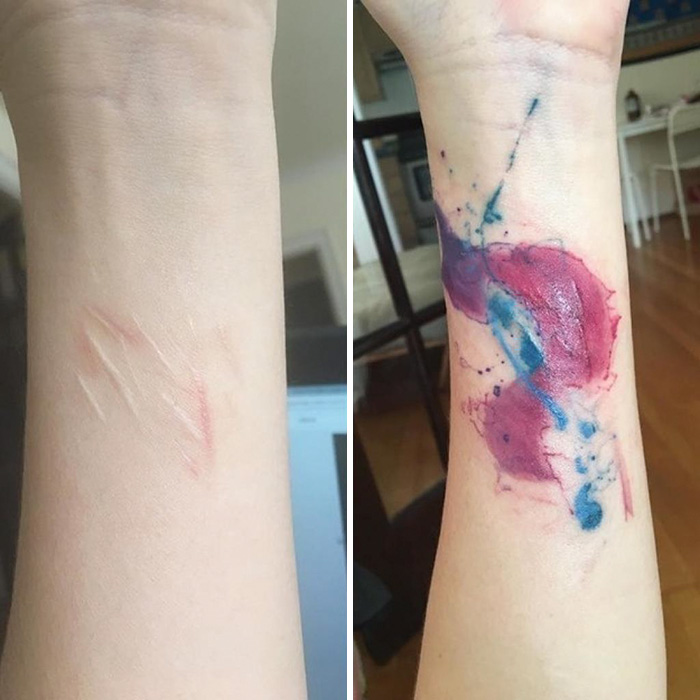 tattoos-covering-scars-stories-32-57ea75f865931__700