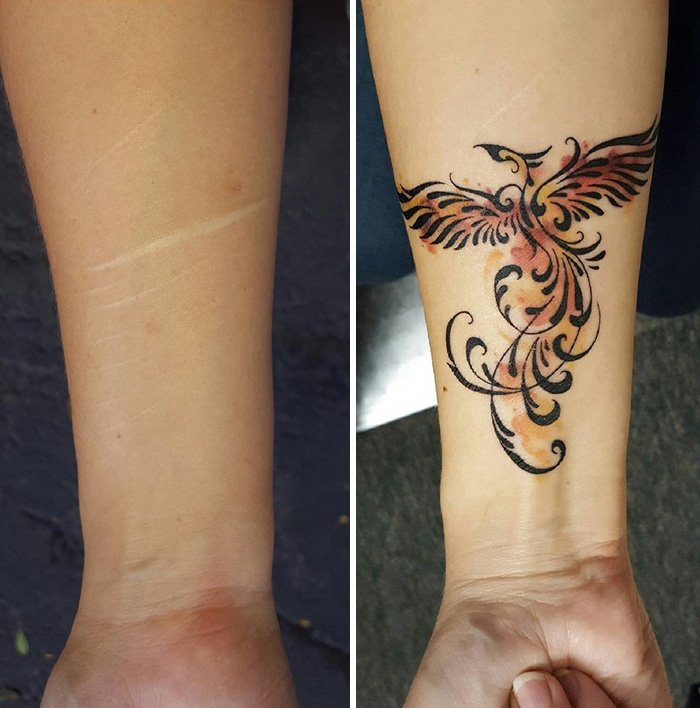 tattoos-covering-scars-stories-38-57ea823a19ec7__700